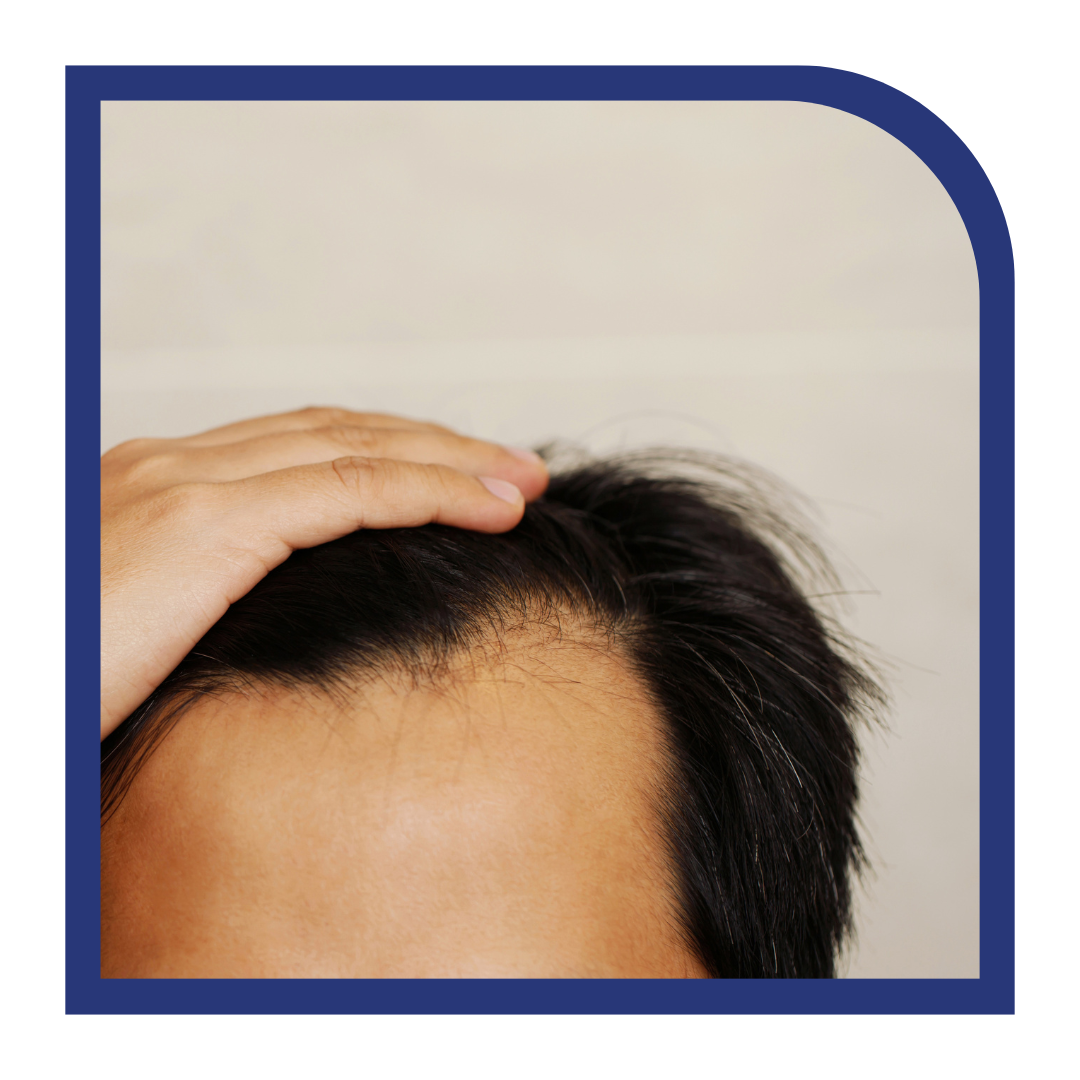 Scalp Simulator Treatment 21 Medical Aesthetics Clinic