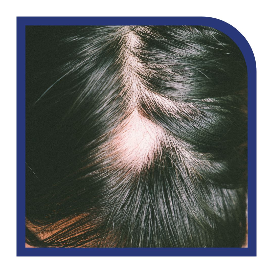 Scalp Simulator Treatment 21 Medical Aesthetics Clinic